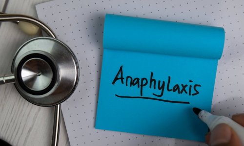 Managing ANAPHYXLAXIS
